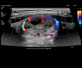 seco-doppler